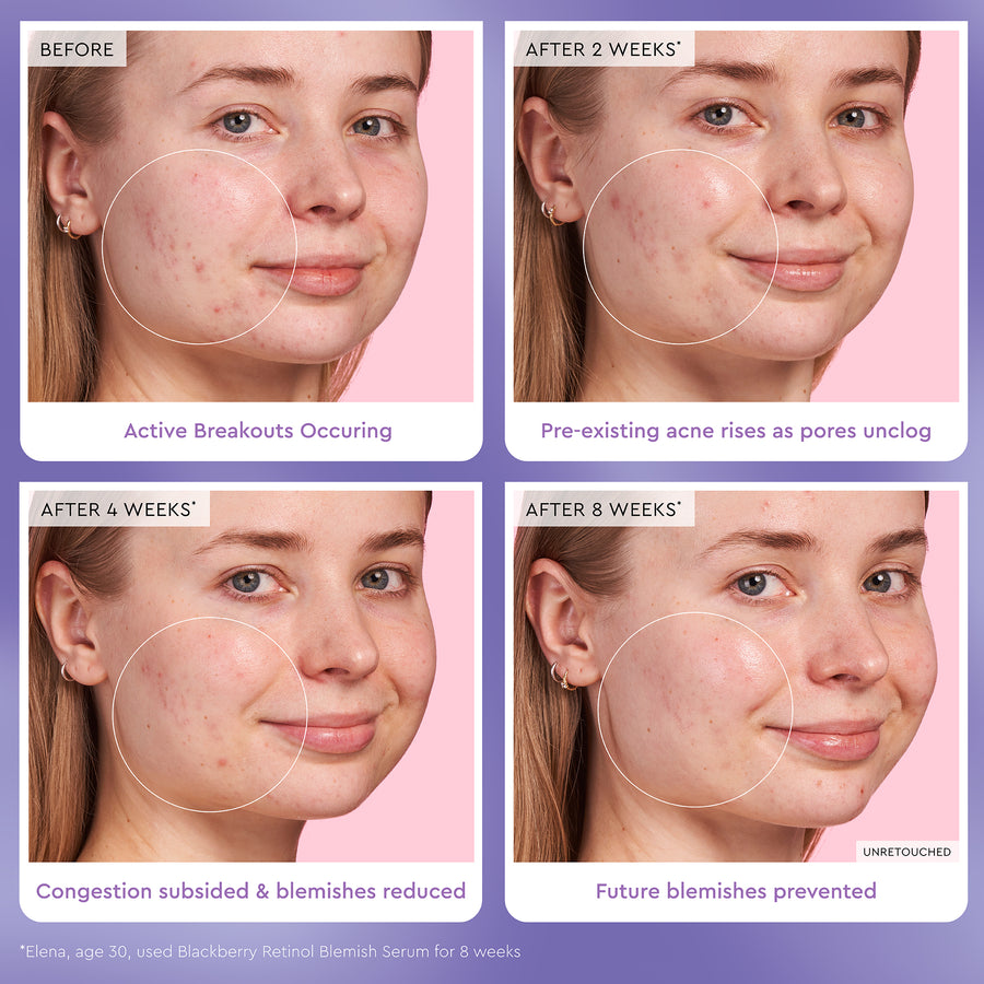 blackberry retinol blemish serum