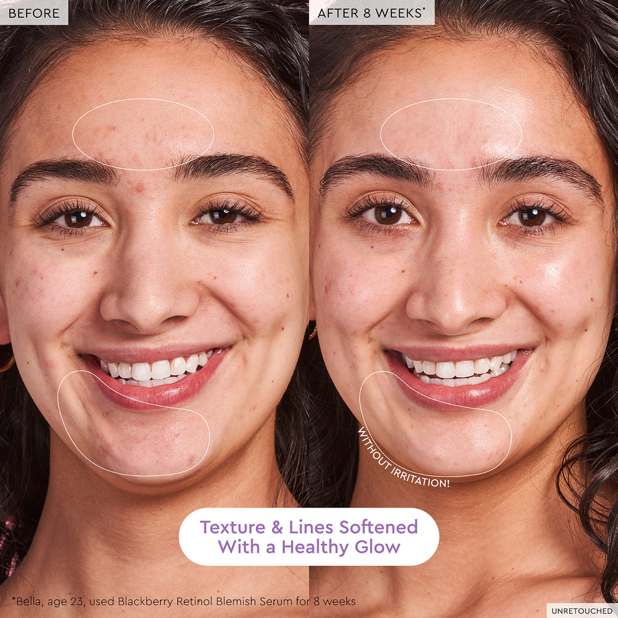 blackberry retinol blemish serum